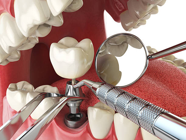 Best Orthodontic Emergency Dentist in Ashland, IL